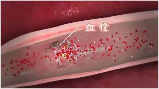 2种运动被称完美体育为“长寿运动”每天坚持这个时长死亡率最低！(图2)